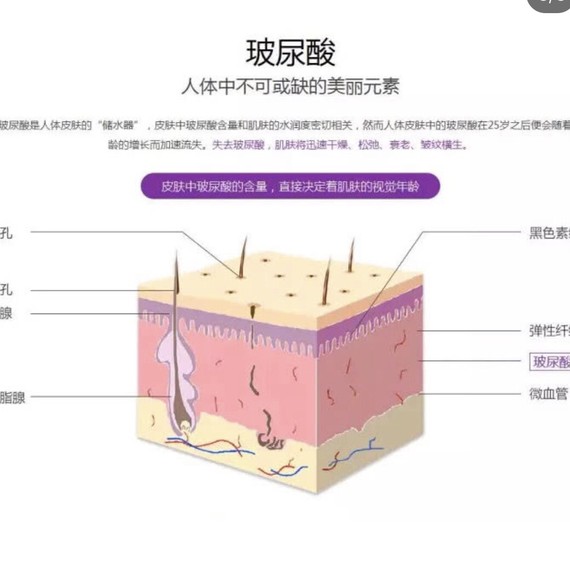 玻尿酸是不会出现脸僵的,出现脸脸僵是因为,注射过量或注射层次不对