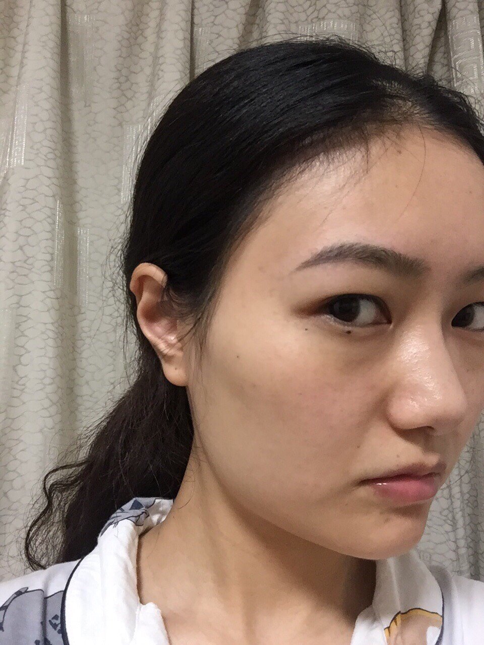 本人面部干瘪,别的不求,只希望轮廓流畅些,然后去除下该死的法令纹,让