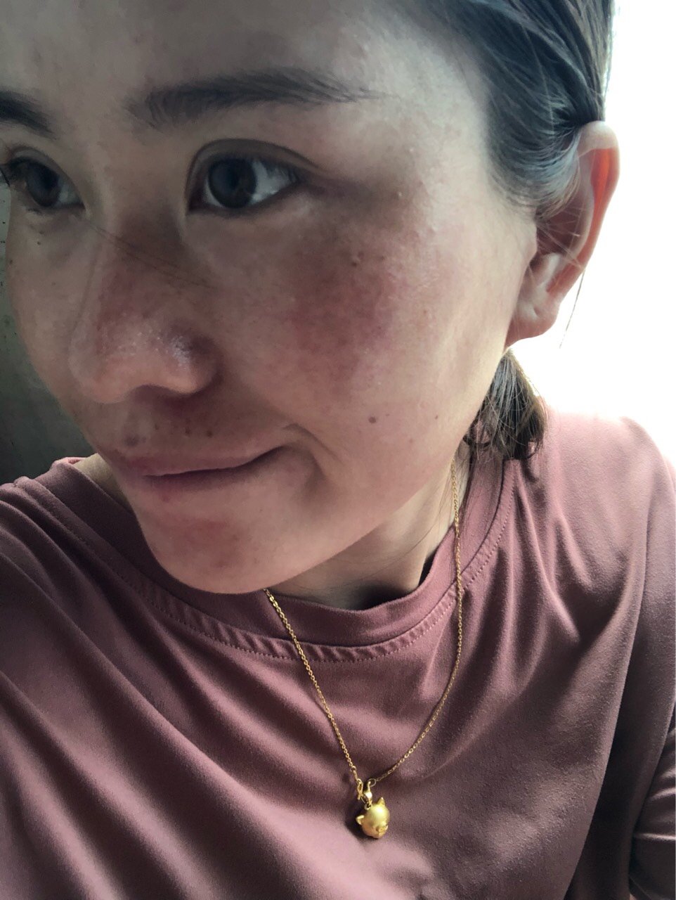 这张脸我已经不知道怎么办了……角质层薄,洗脸不敢洗,护肤品也不敢用