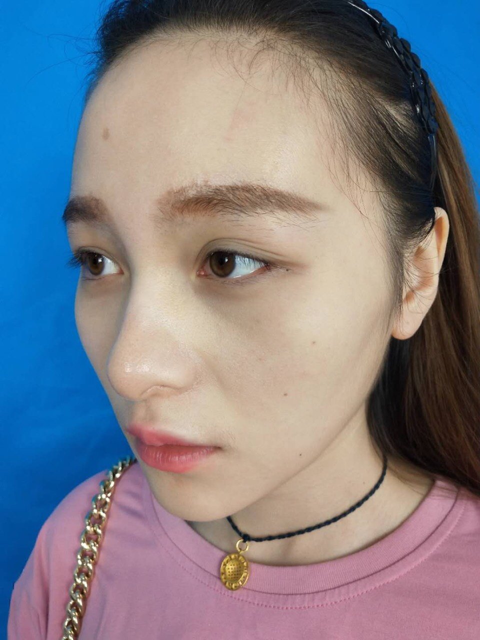 注意这些情况会导致多层眼皮!