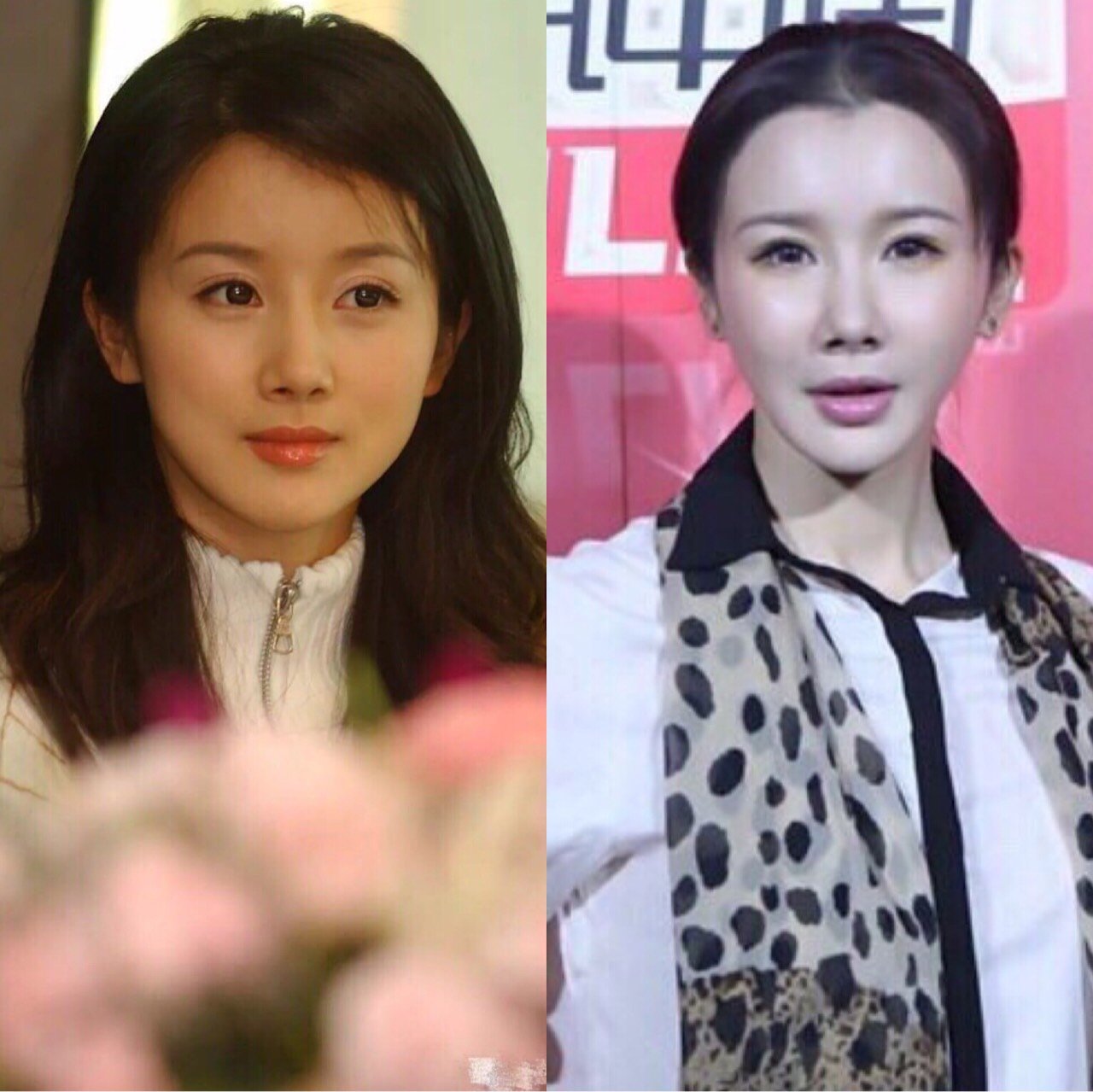 整容反例之孙菲菲74 当年多么清纯水灵0269♀15 这种_圈子