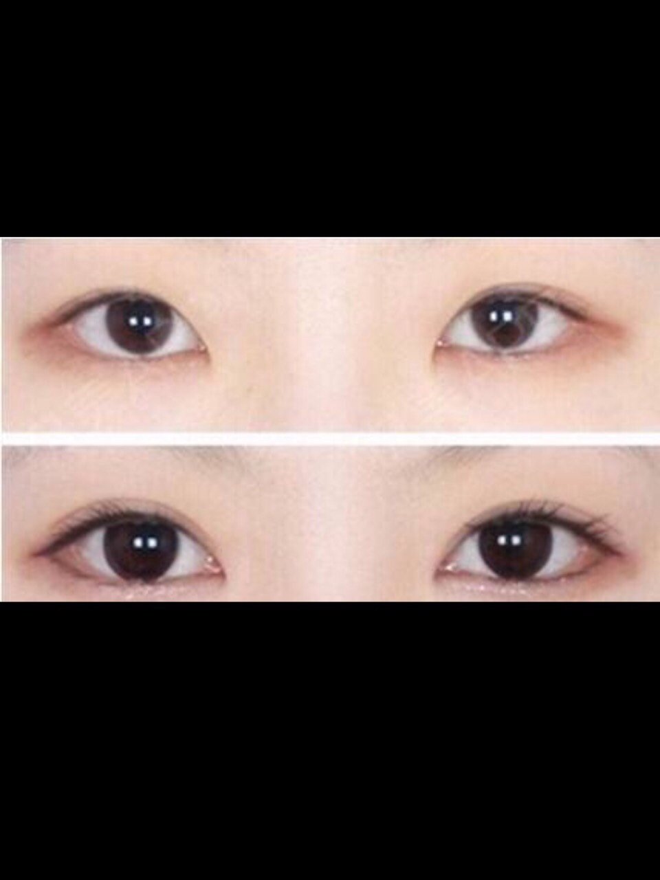 开外眼角和眼睑下至的区别