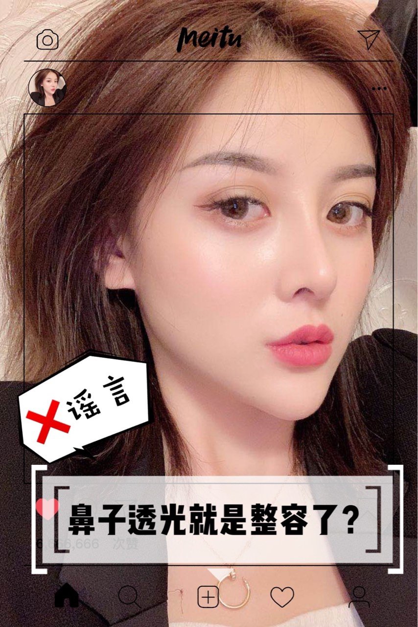 【姚院小课堂】鼻子透光就一定是整容了谣言粉碎自然鼻也可能透光