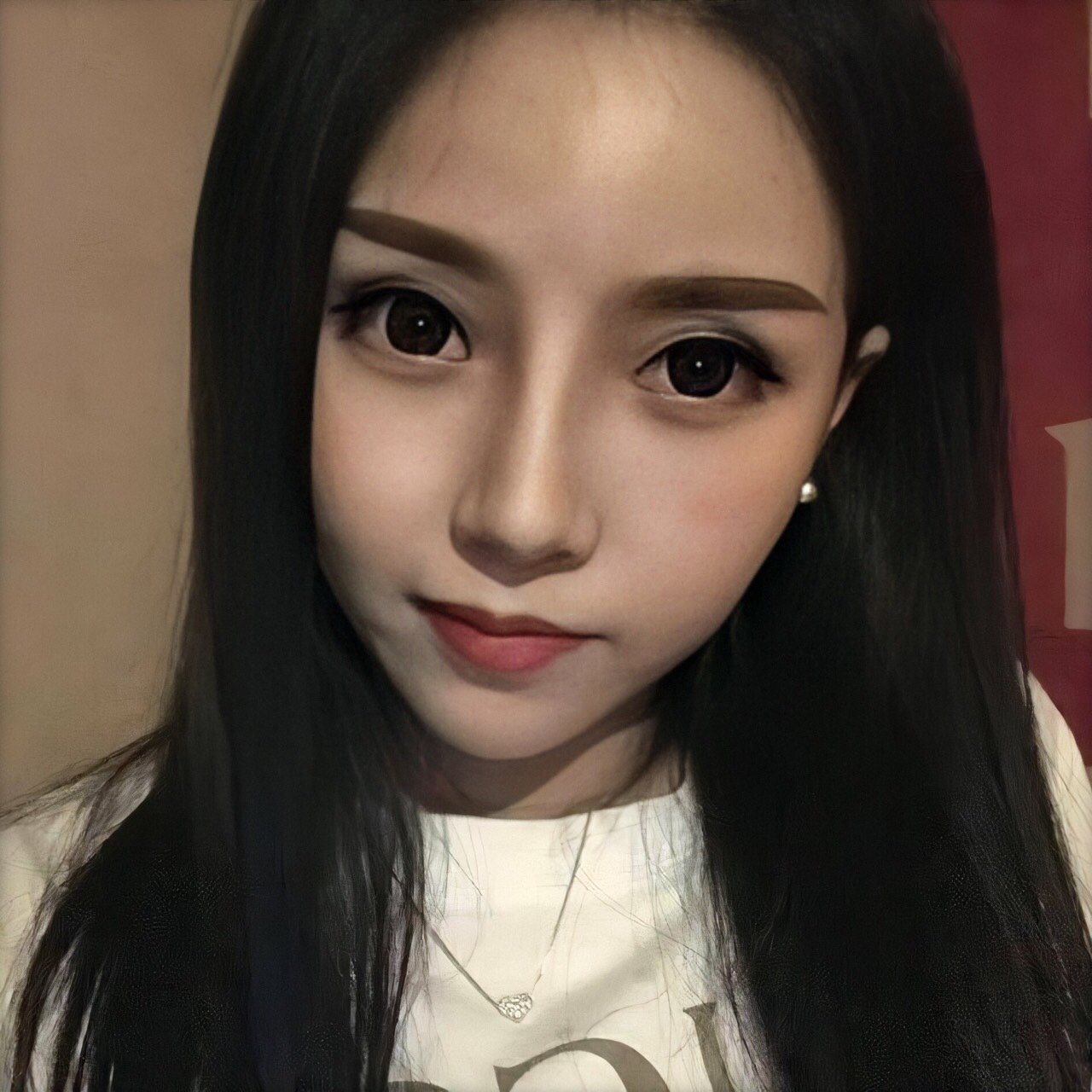 我第一次接触整形和大部分女生一样,做的双眼皮