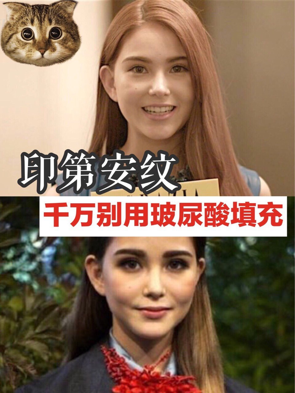 印第安纹在台湾有个比较萌的别称 叫 猫咪纹 因 圈子 新氧美容整形