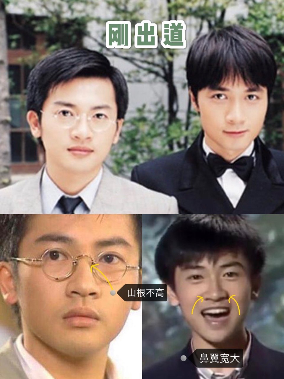 惊!苏有朋的鼻子怎么变成了这样