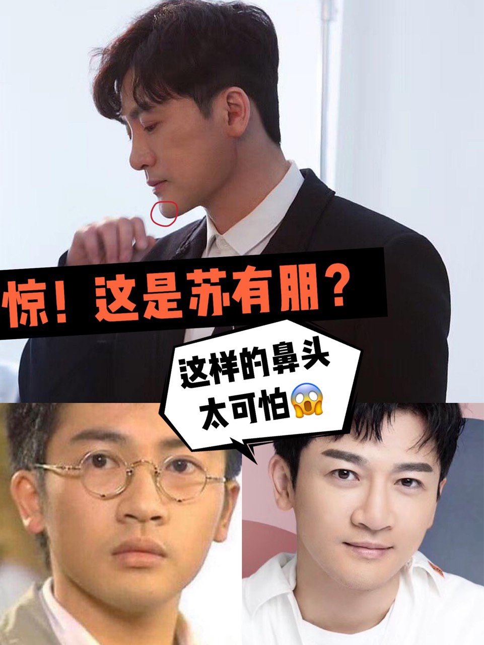 惊!苏有朋的鼻子怎么变成了这样