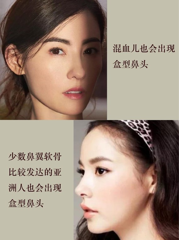 韩国第一美女用"绝美鼻型"告诉你明星和网红的区别