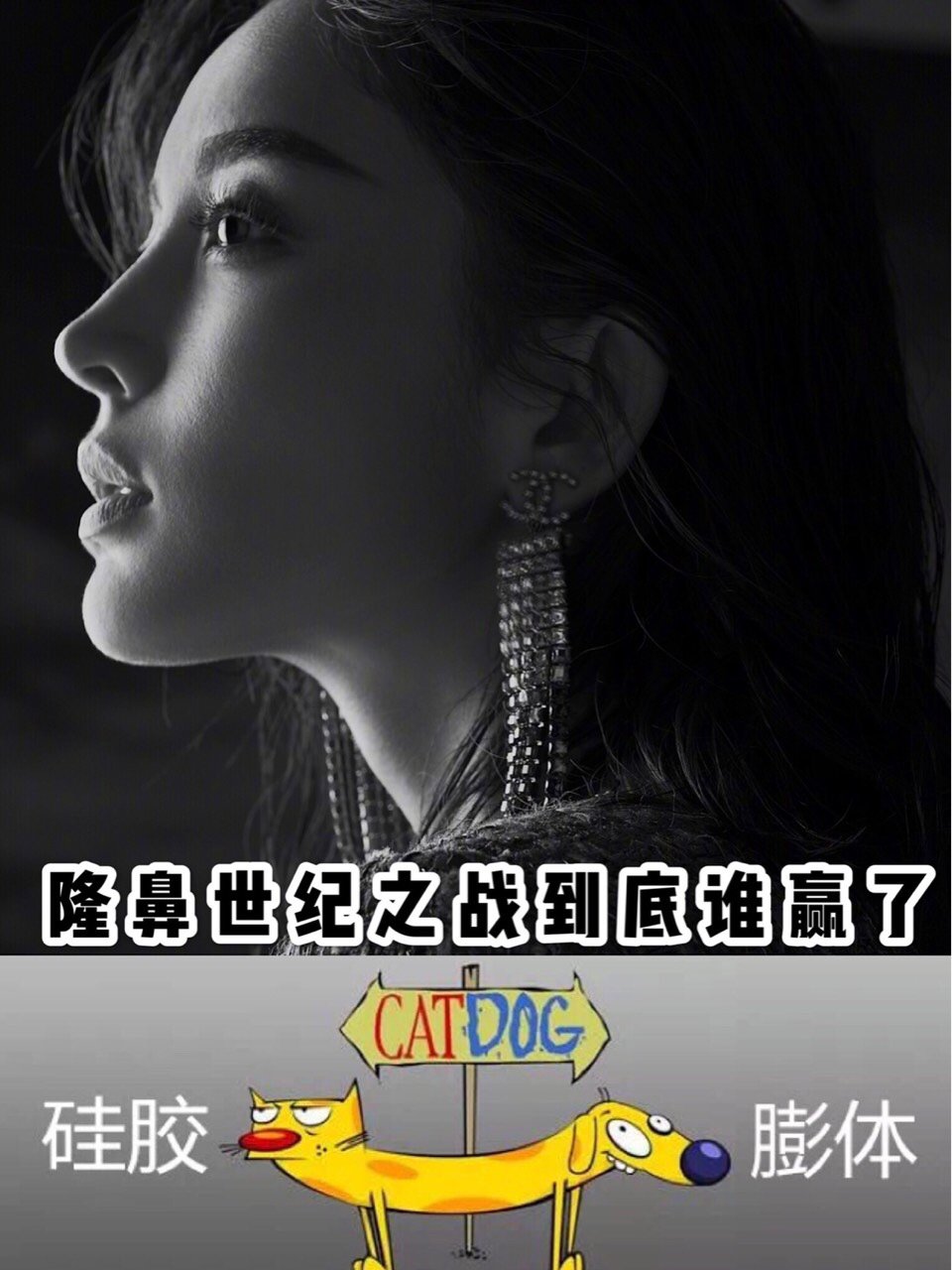 做隆鼻手术要好多钱_隆鼻手术贵吗_隆鼻手术多少钱
