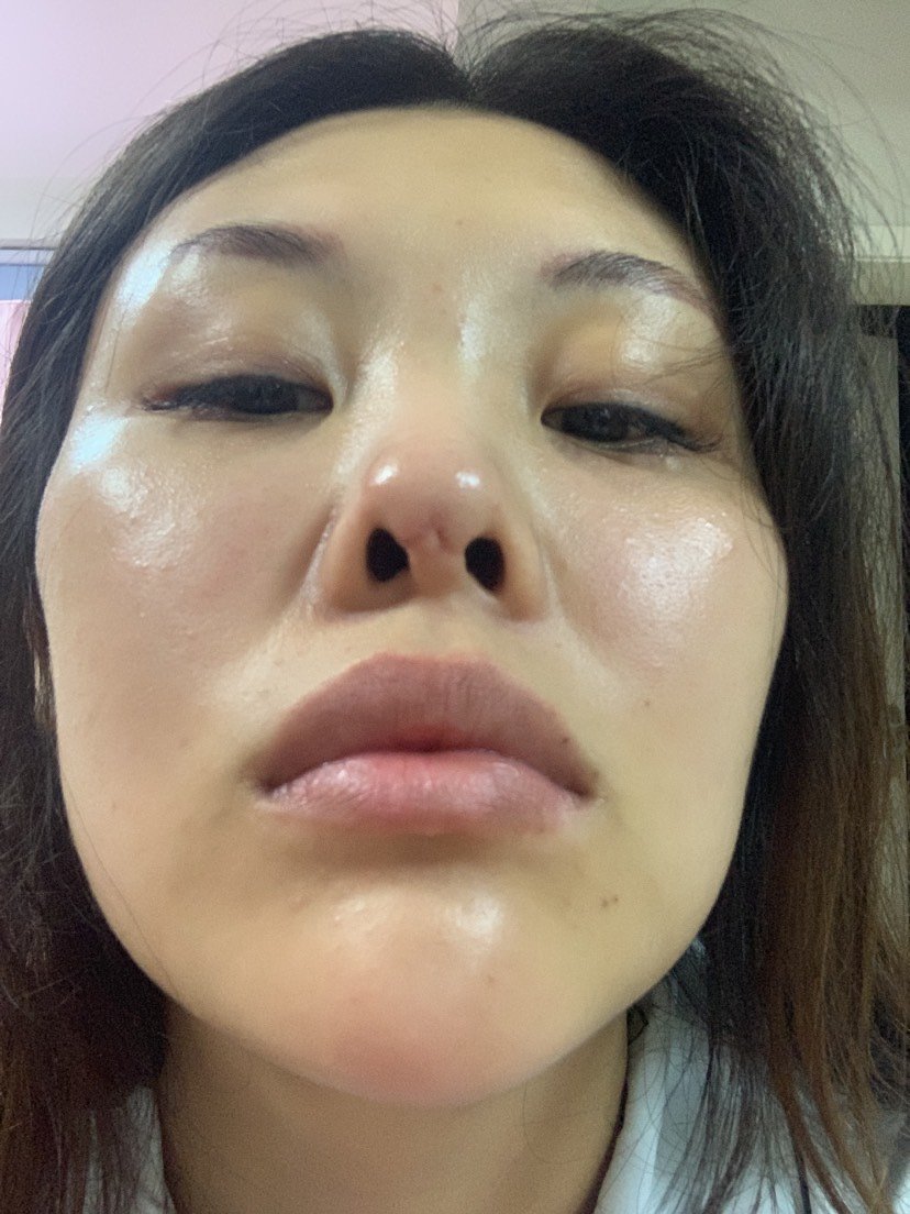我的鼻子做坏了想要做修复,请问哪家医院做修复最好