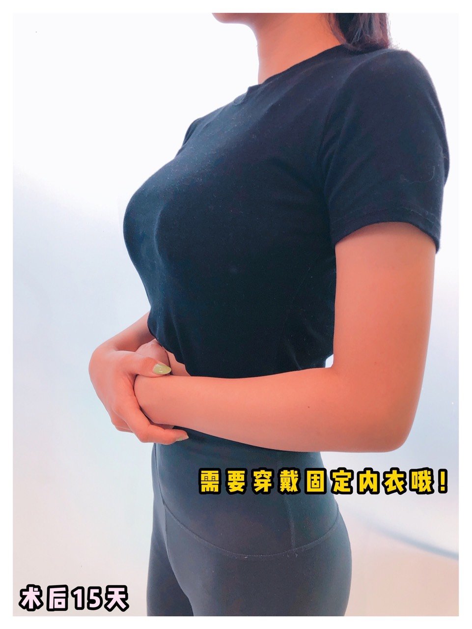 少女酥胸变大妈胸!胸部下垂怎么办?