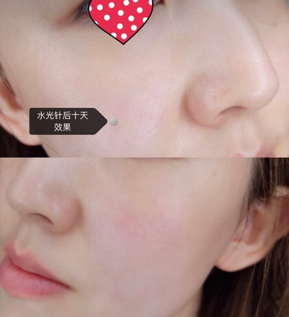 菲洛嘉水光补水