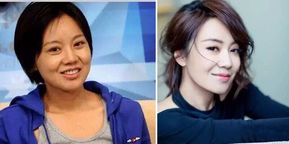 看看图中闫妮的前后变化_圈子-新氧美容整形