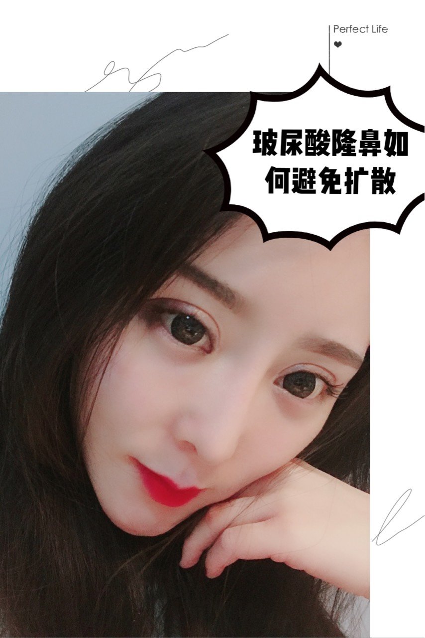 玻尿酸隆鼻如何防止扩散秒变阿凡达品牌很重要