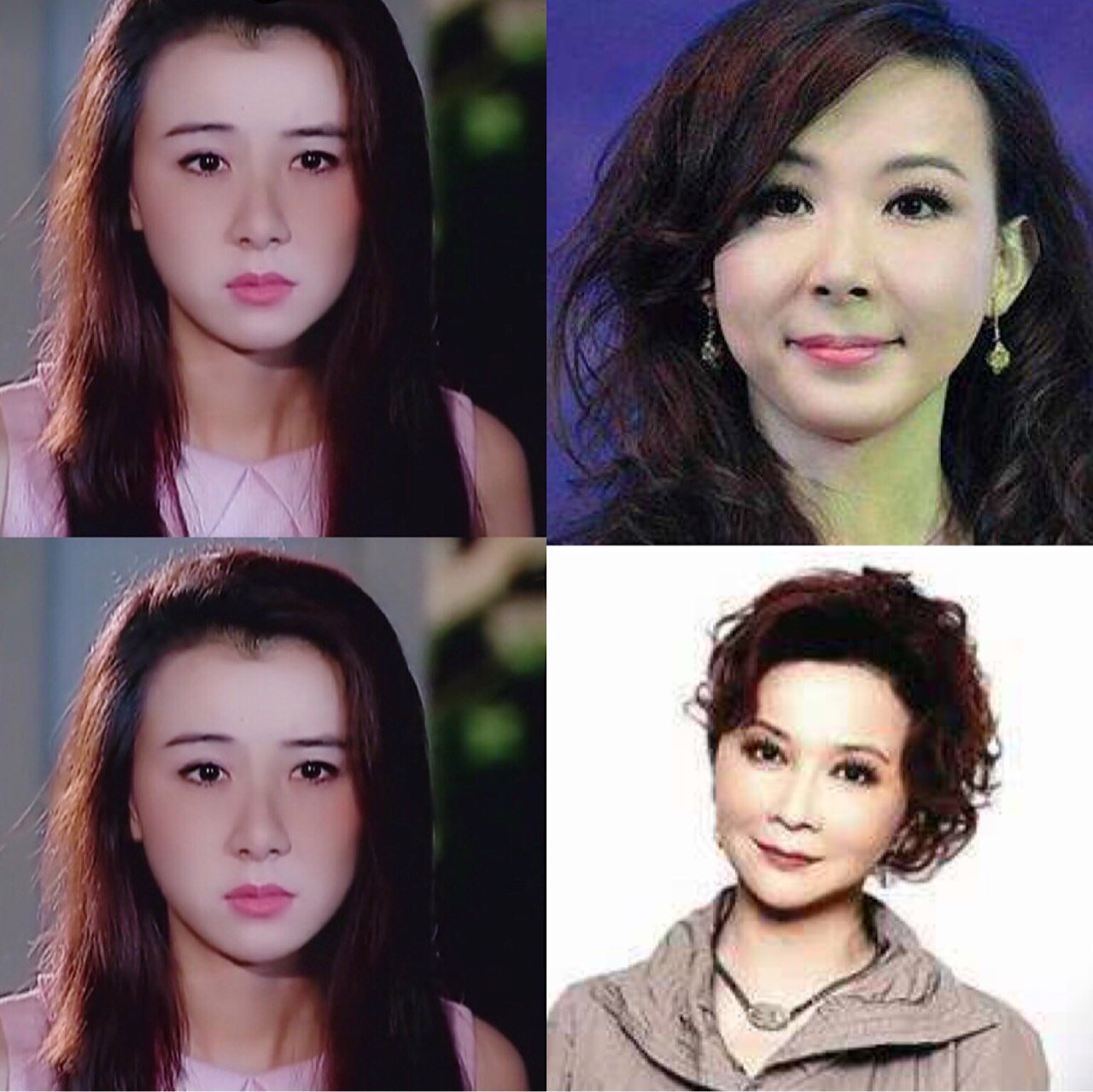 看到一个很有意思的标题90说每一个整容的尽头都是蔡明_圈子-新氧