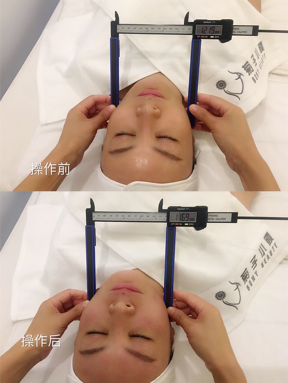 再次试水:日式小颜徒手整骨.