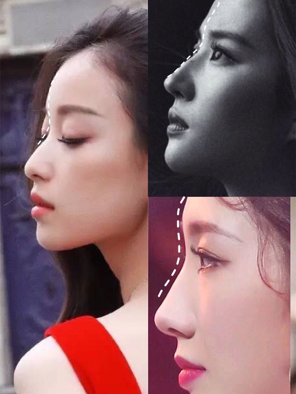 你做的假鼻子9199根本不会被发现!7315前_圈子-新氧美容整形