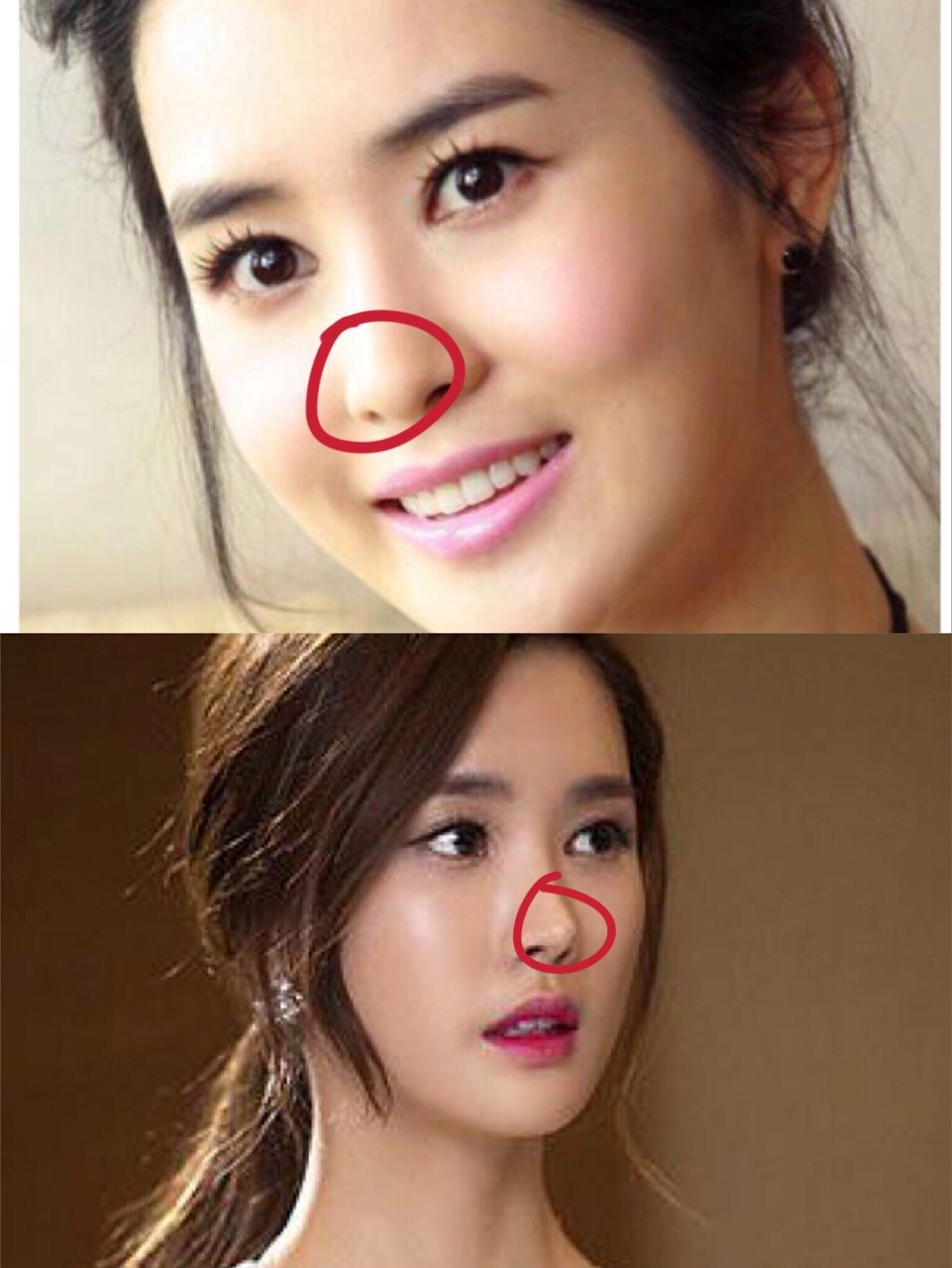 你做的假鼻子9199根本不会被发现!7315前_圈子-新氧美容整形