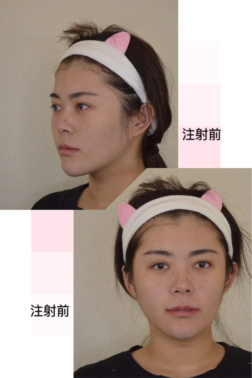 艾瑞巴蒂