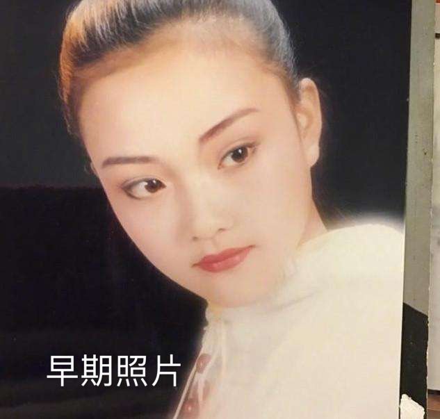 今天想来说说娱乐圈有名的热衷整形的明星李小璐!