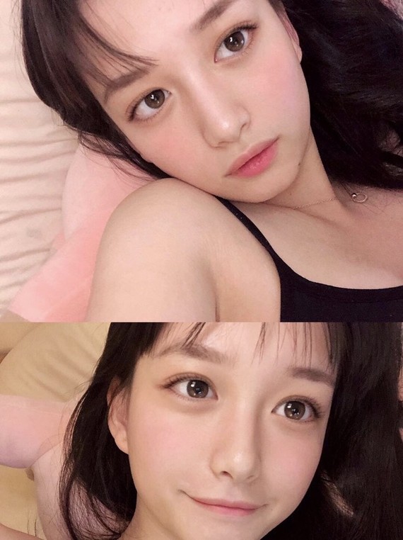 之前横空出世的网红susansu,各位应该也眼熟了_圈子-新氧美容整形