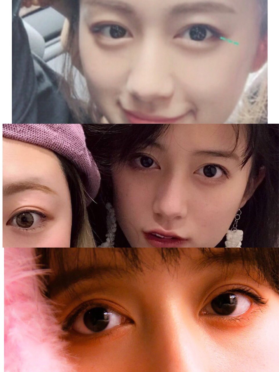 医美美商进阶||被众多女明星夸赞天然神颜的黑尾酱做_圈子-新氧美容