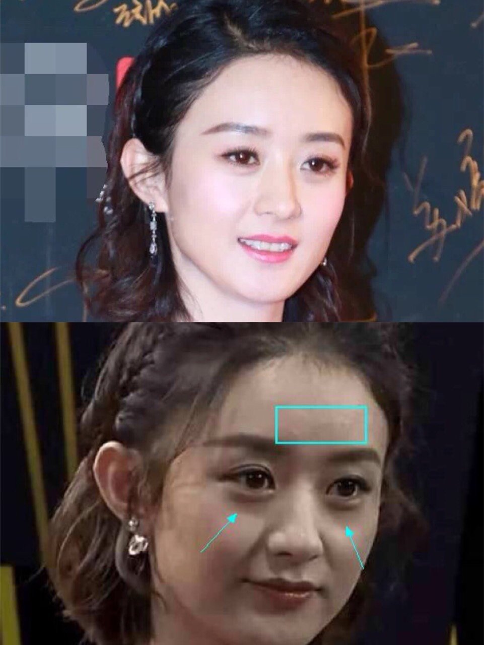 困扰全球98%的人,高颜值女明星都躲不开的颜值bug—黑眼圈!