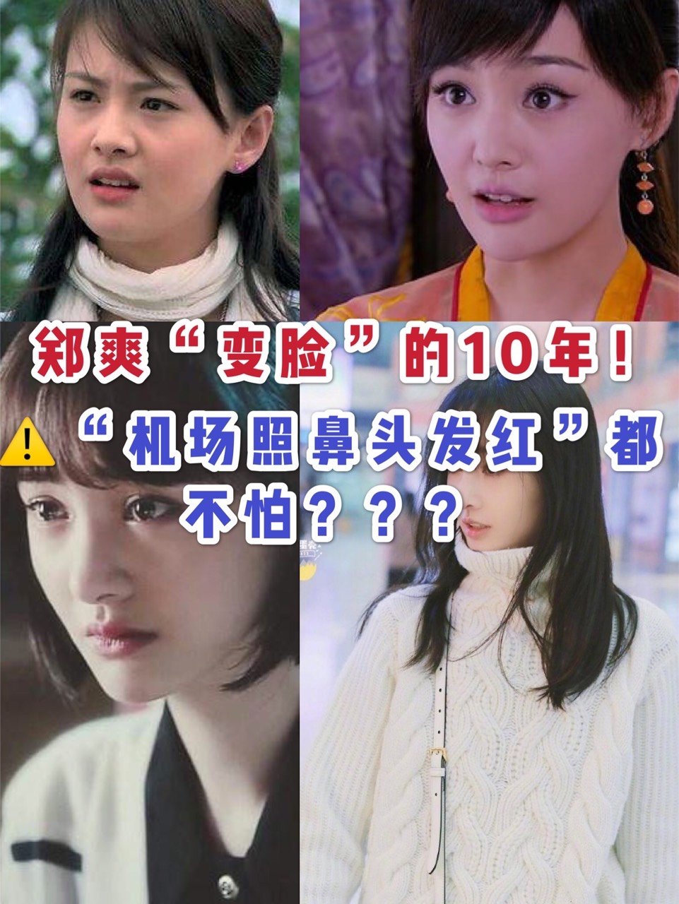 "郑爽机场照鼻头发红"请问你是又去动鼻子了吗!