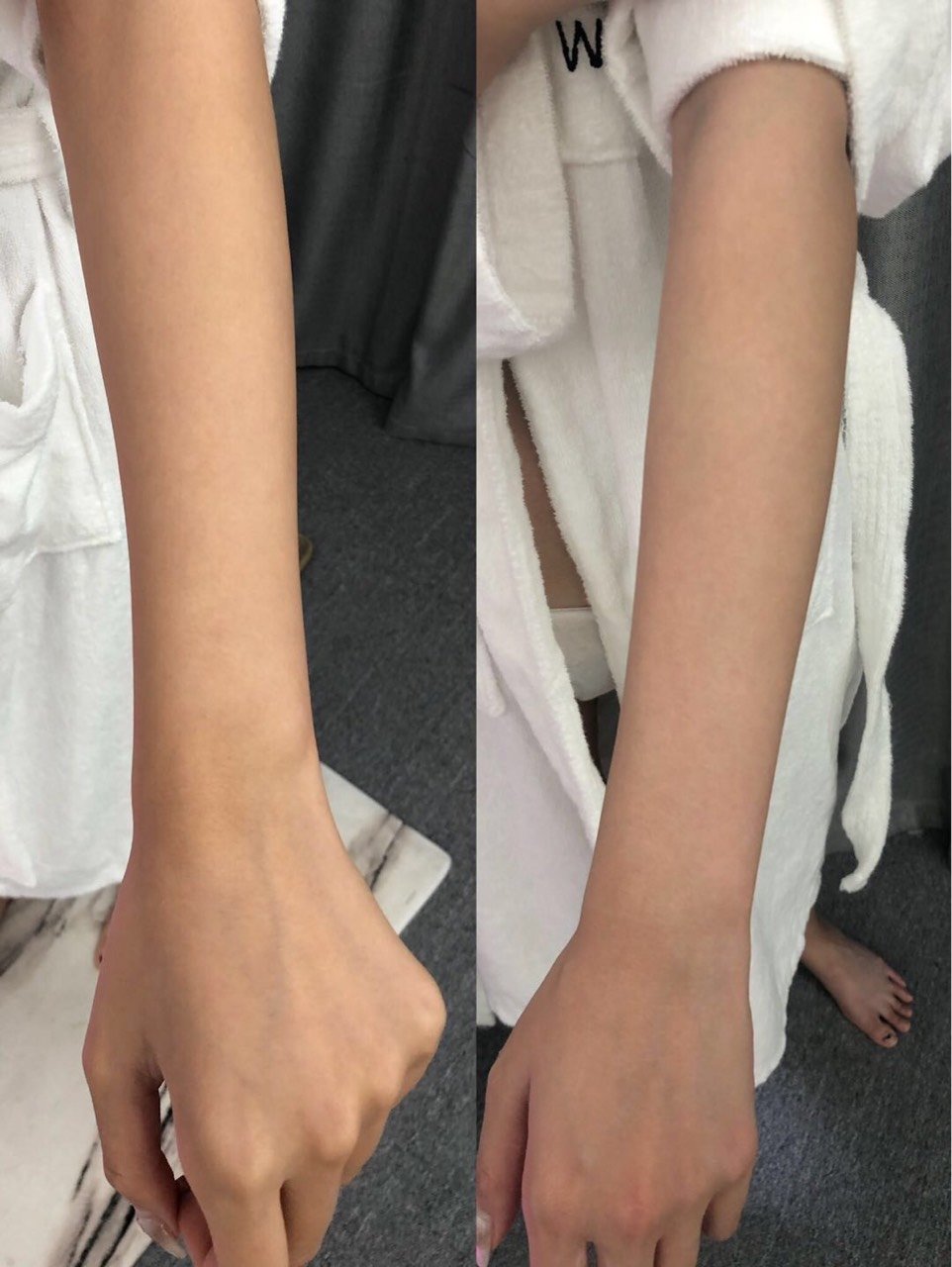 美白舱为何值得推荐 知识点跟你唠一唠据了解 黑色 圈子 新氧美容整形