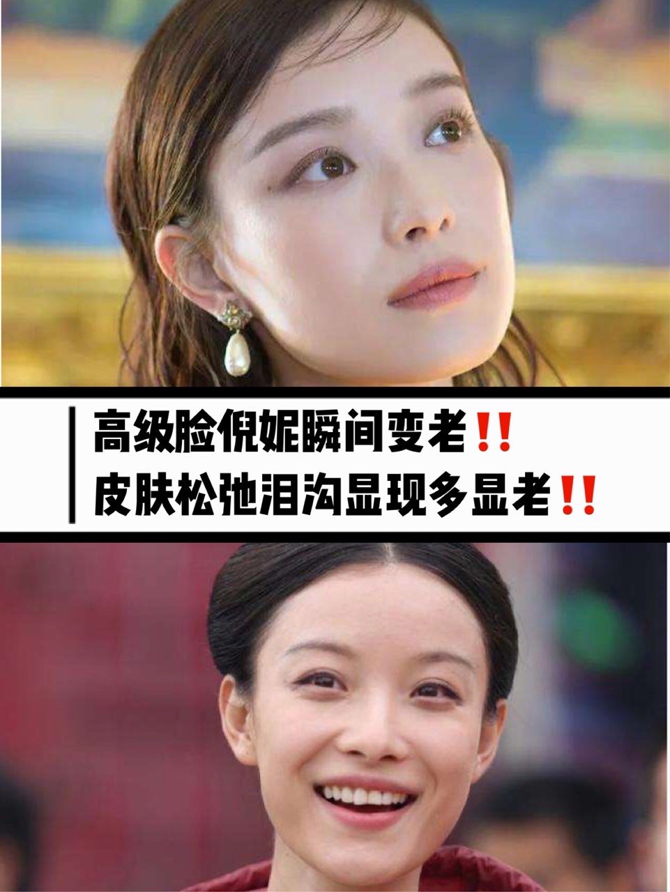 高级脸倪妮瞬间变老皮肤松弛泪沟显现多显老
