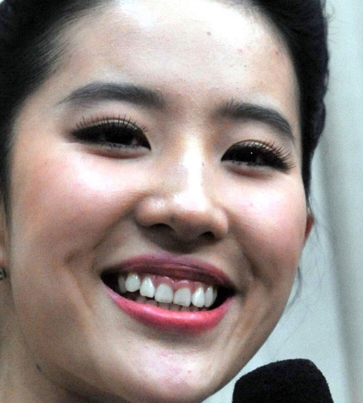 99一说到贵圈"一笑毁所有"的明星,第一个想到的就是_圈子-新氧美容