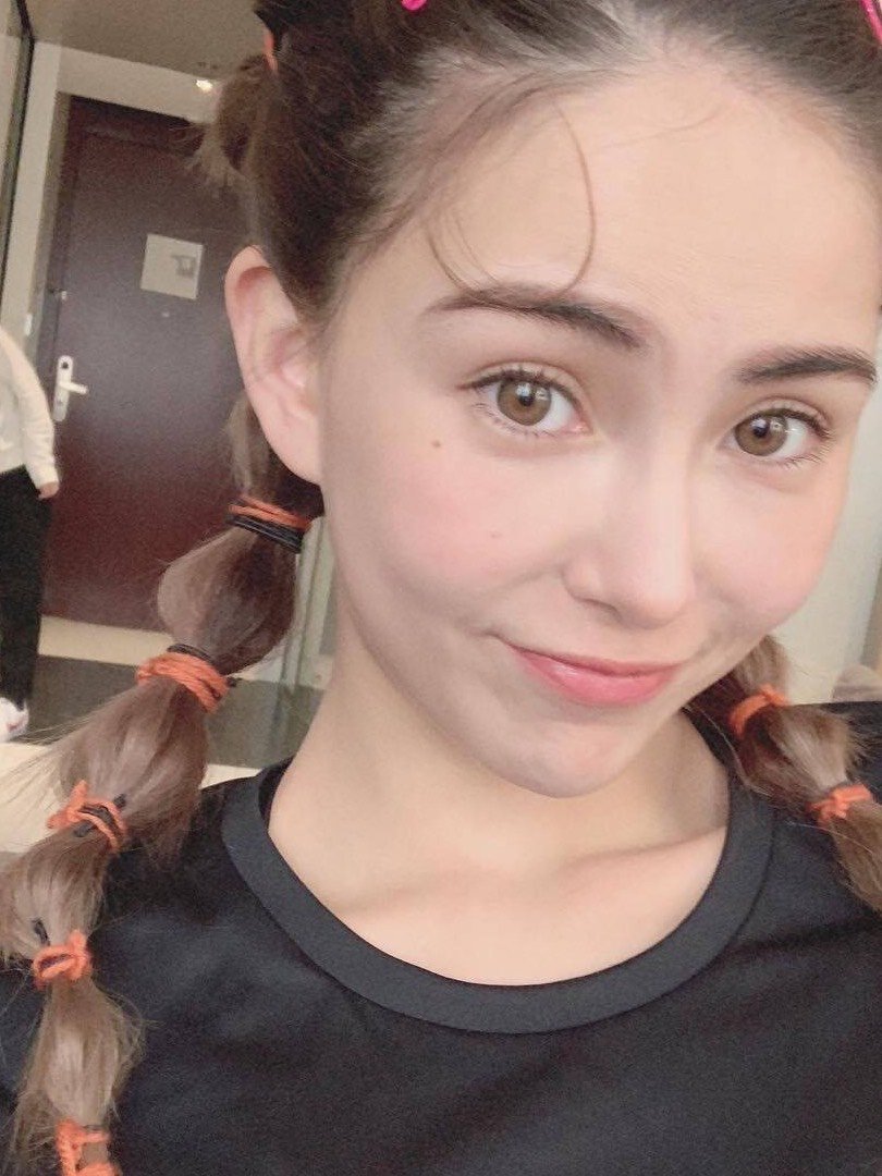 昆凌填充出现纹路其实都是泪窝搞的鬼