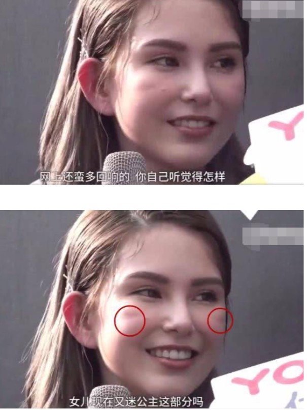 昆凌填充出现纹路其实都是泪窝搞的鬼