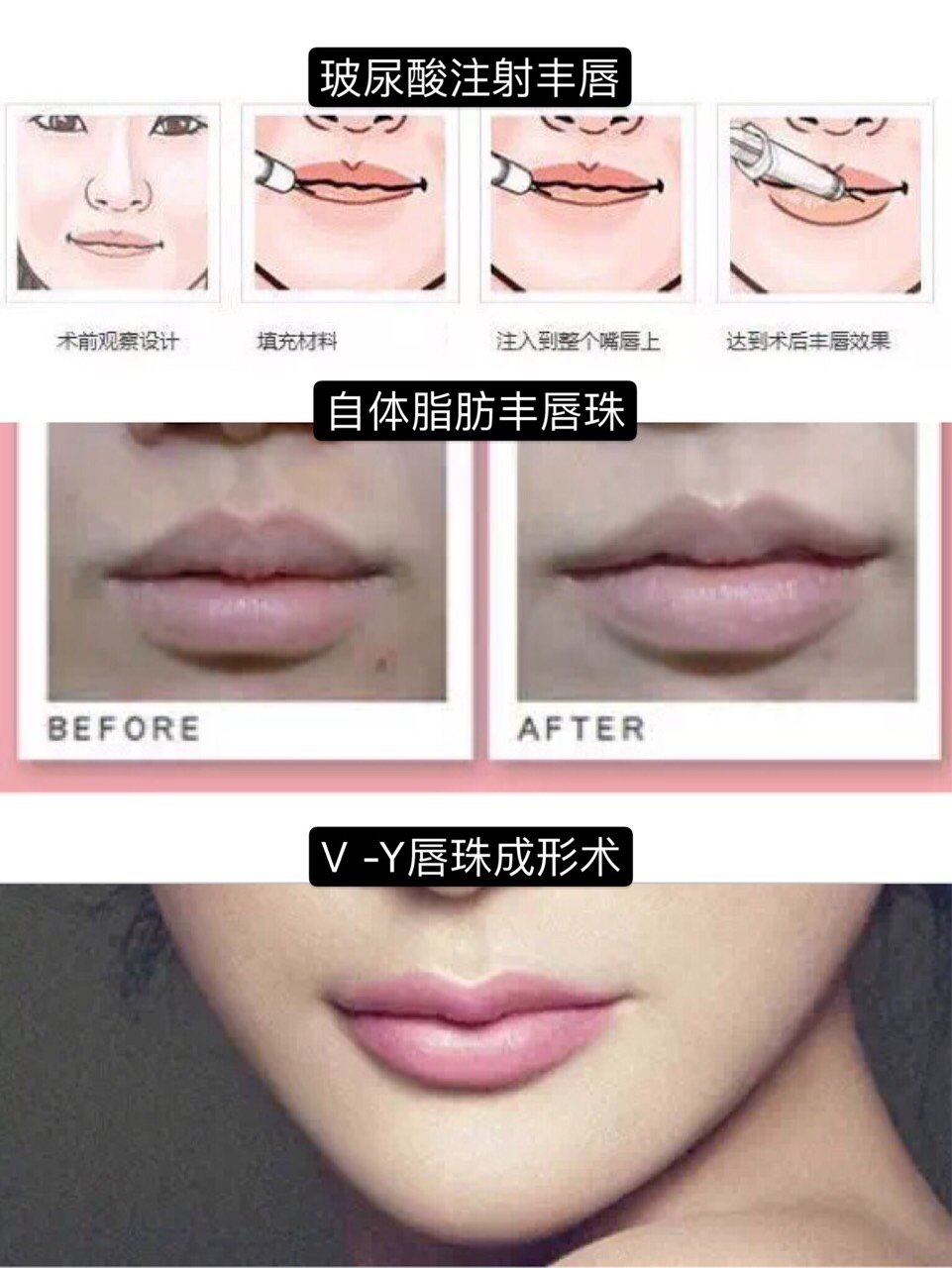 没有唇珠你跟我谈什么性感