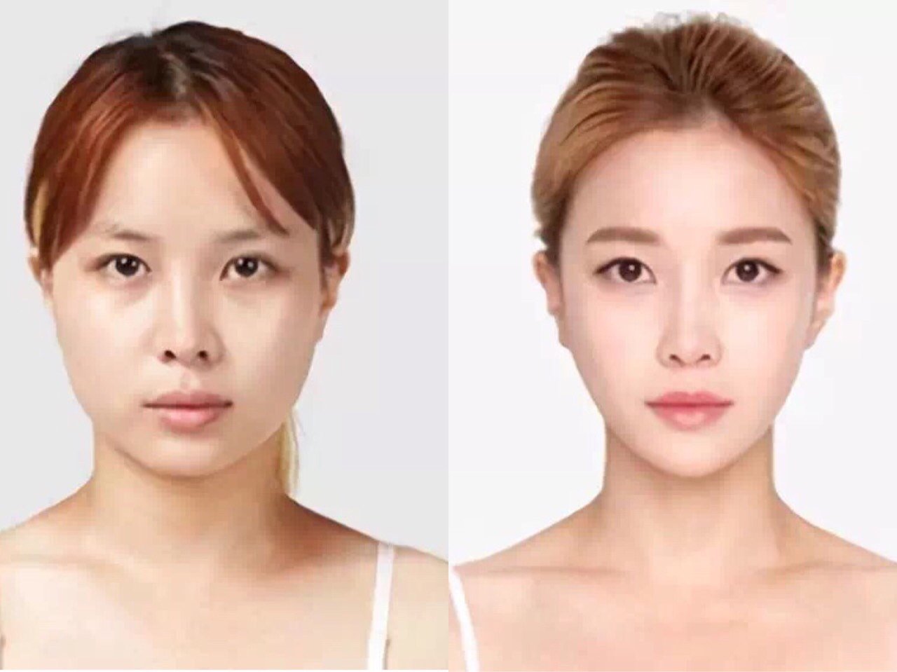 很多小仙女们初涉医美,对整形一知半解,想尝试却