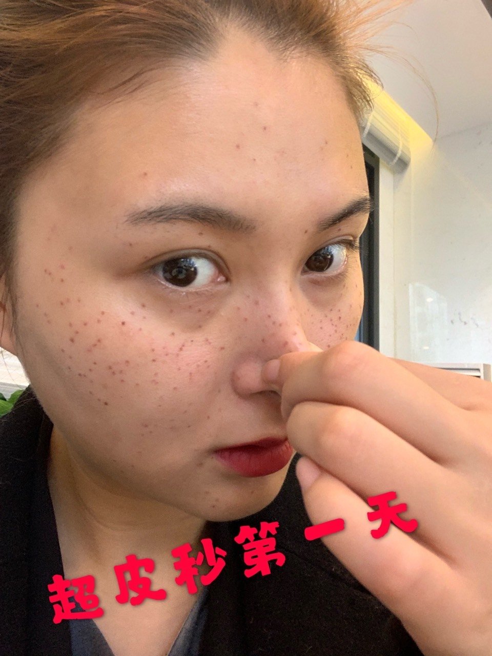 超皮秒第一天