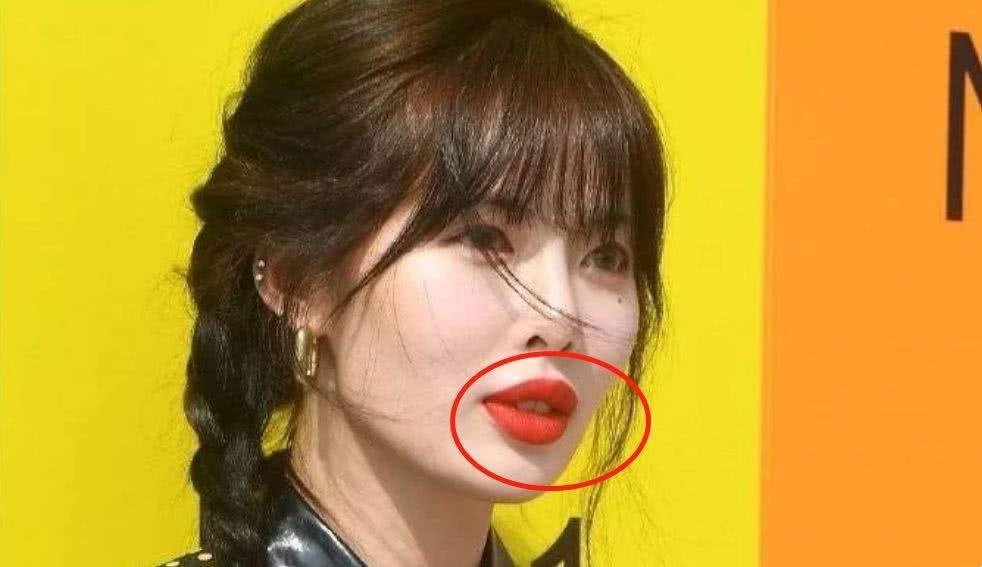 比如刘亦菲,恰到好处的颏唇沟让她的下巴有了更好的层次感和立体度