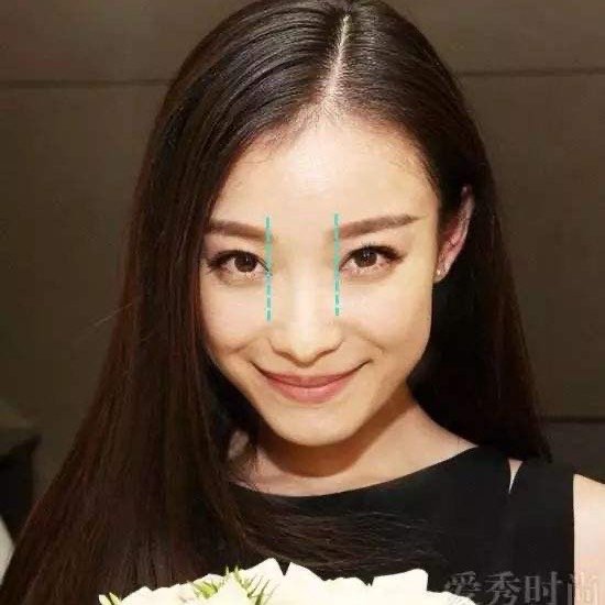 眼间距指的是两眼内眼角之间的距_圈子-新氧美容整形