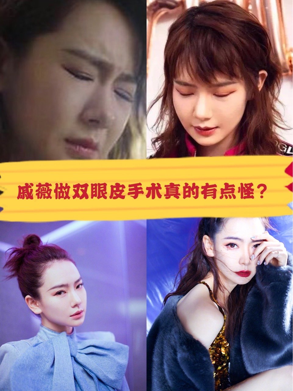 戚薇做双眼皮手术真的有点怪?