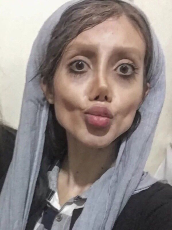 虽然整容已经不是什么新鲜的事情了,但是把自己整成