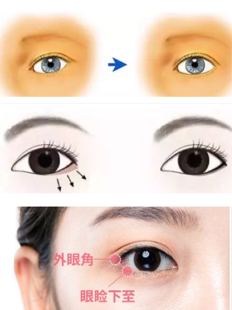 女明星们的清纯无辜眼都是靠这项手术美上天?(上)