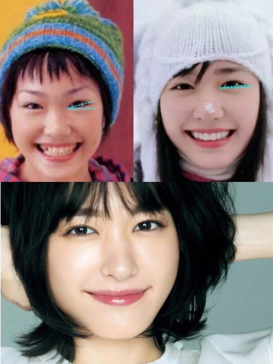 女明星们的清纯无辜眼都是靠这项手术美上天?(上)