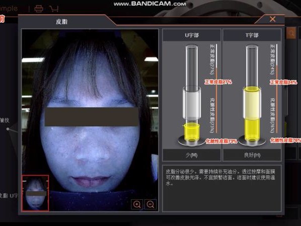 首页 此页面仅支持预览 Avatar 氧气7cr8p 1篇日记 美容院 店长私人笔记 测肤仪器篇今年9月份我在广州美博会体验了美图宜肤测肤仪 高清晰3d人脸及专业人性化ui界面 顾客画像管理后台让我大开眼界 便购置在店内使用 与已有的 A One进行了一个简单的