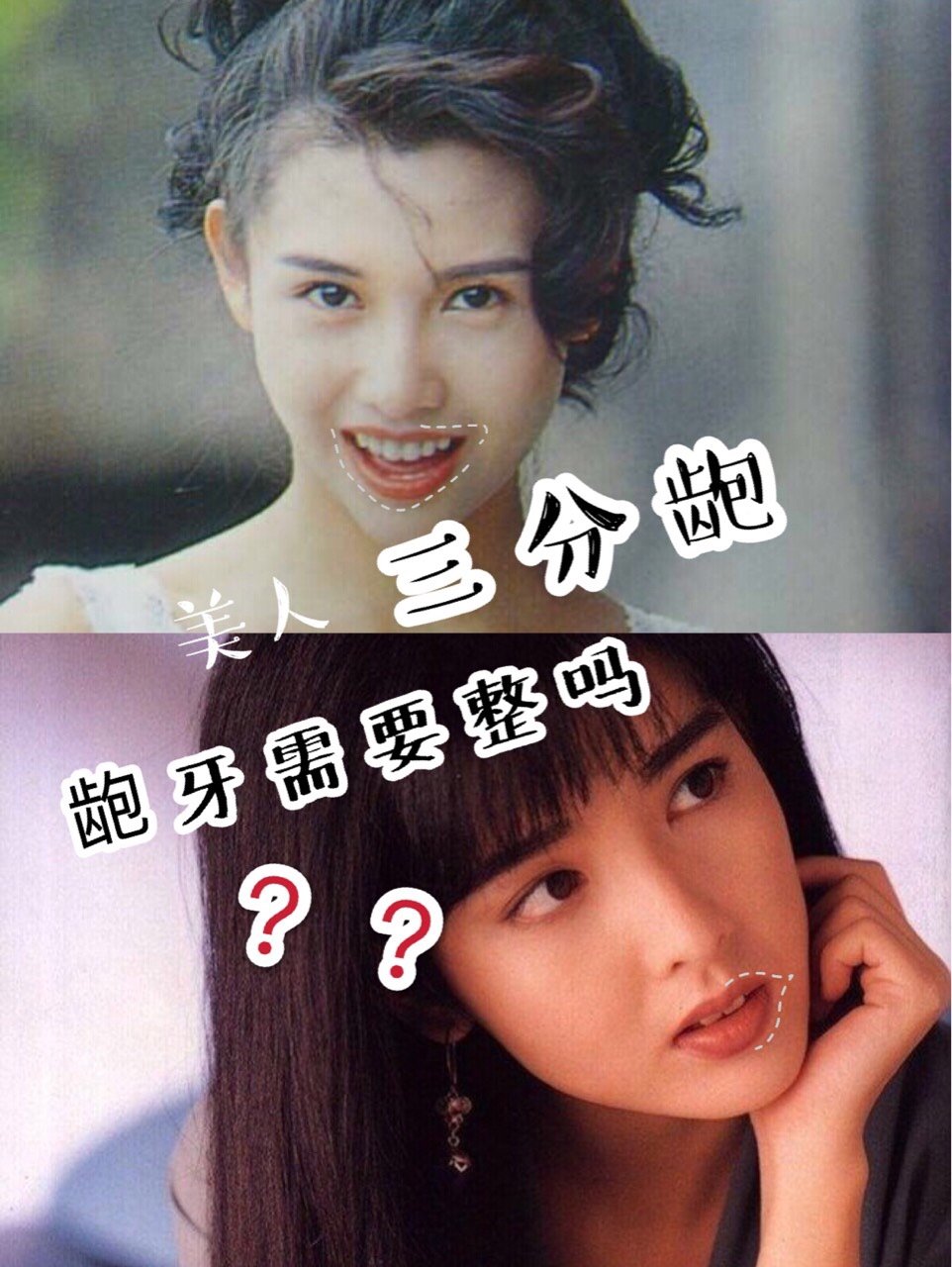 龅牙竟然不需要调整?969595邱淑贞_圈子-新氧美容整形