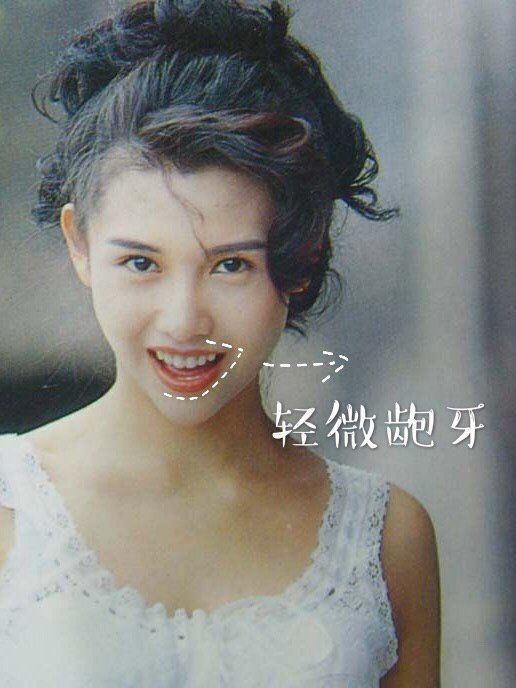 龅牙竟然不需要调整?969595邱淑贞_圈子-新氧美容整形
