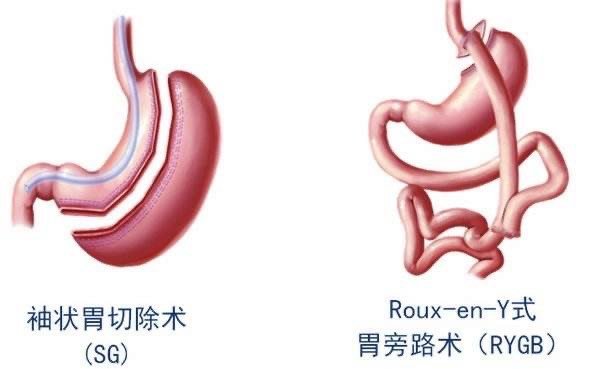 9696#艾瑞巴蒂#宝宝们,琦琦来了019969