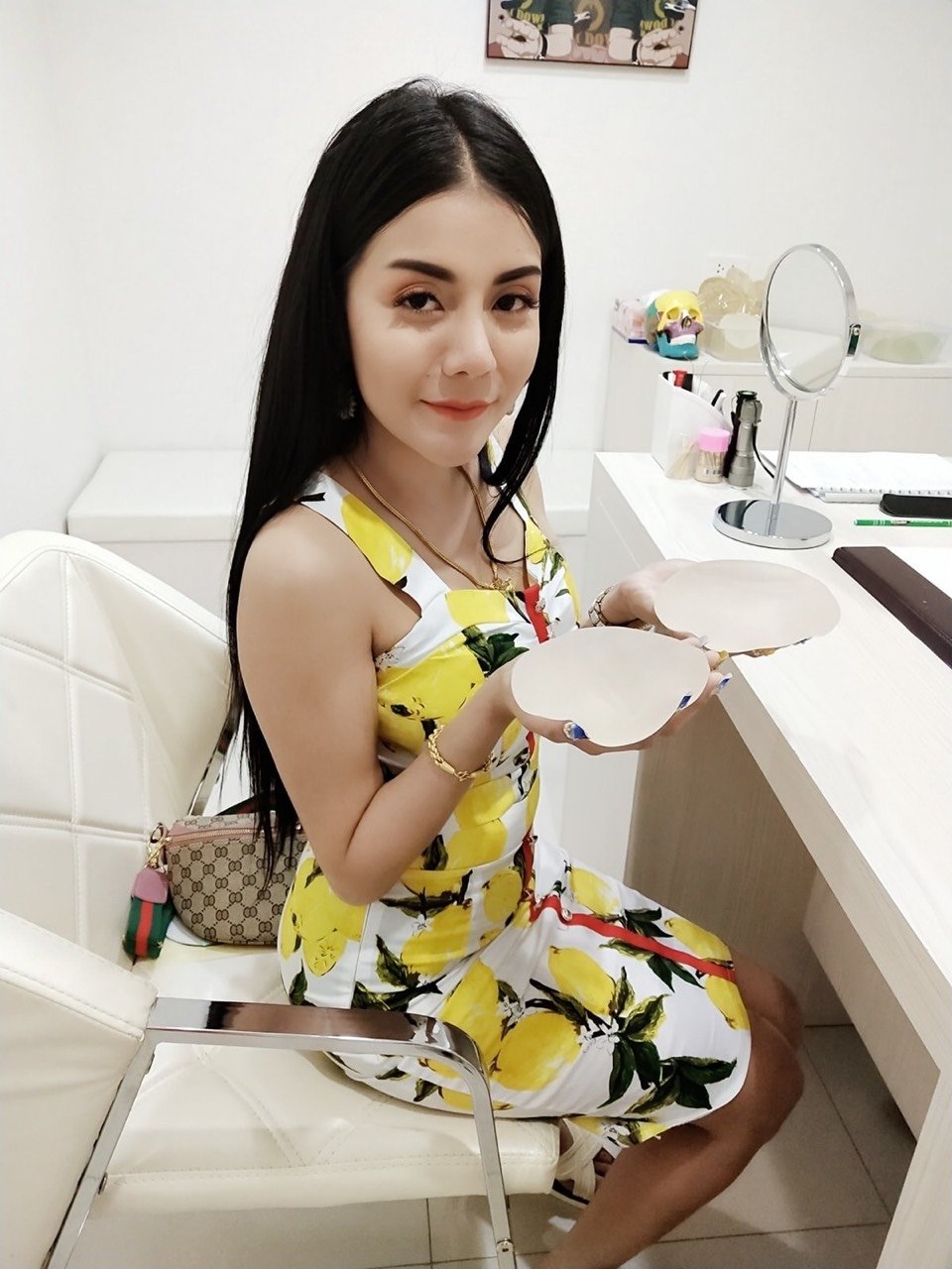 泰国巴黎西施390cc假体隆胸走一个,模特仙女已经_圈子-新氧美容整形