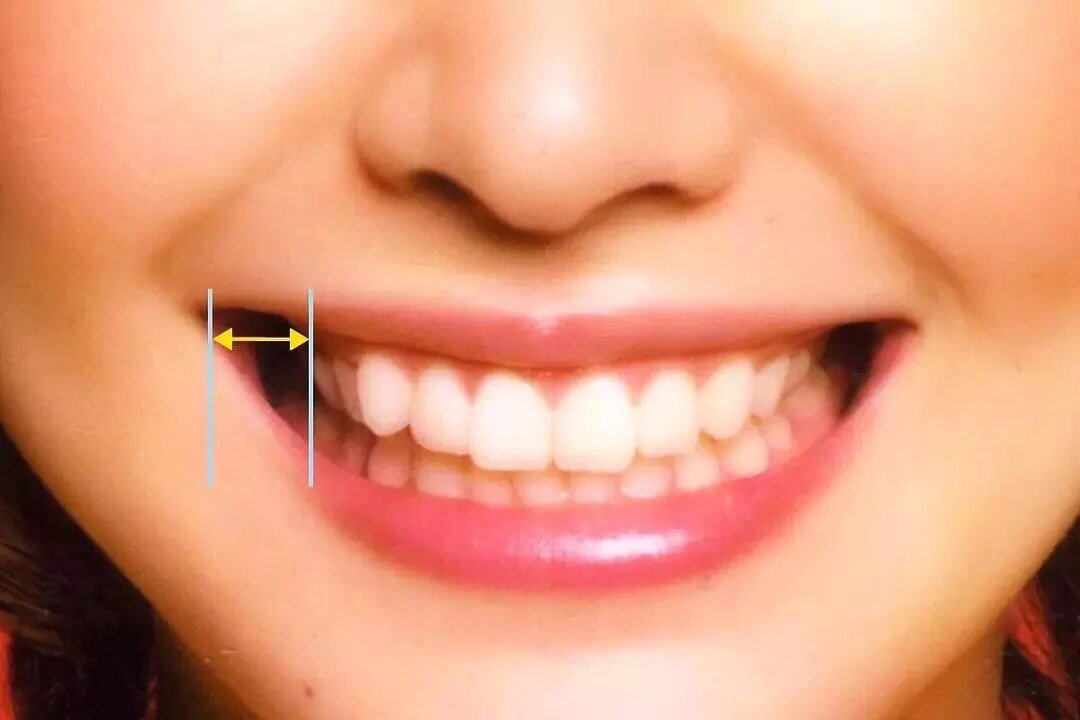 颊廊先来解释下这个陌生的名词