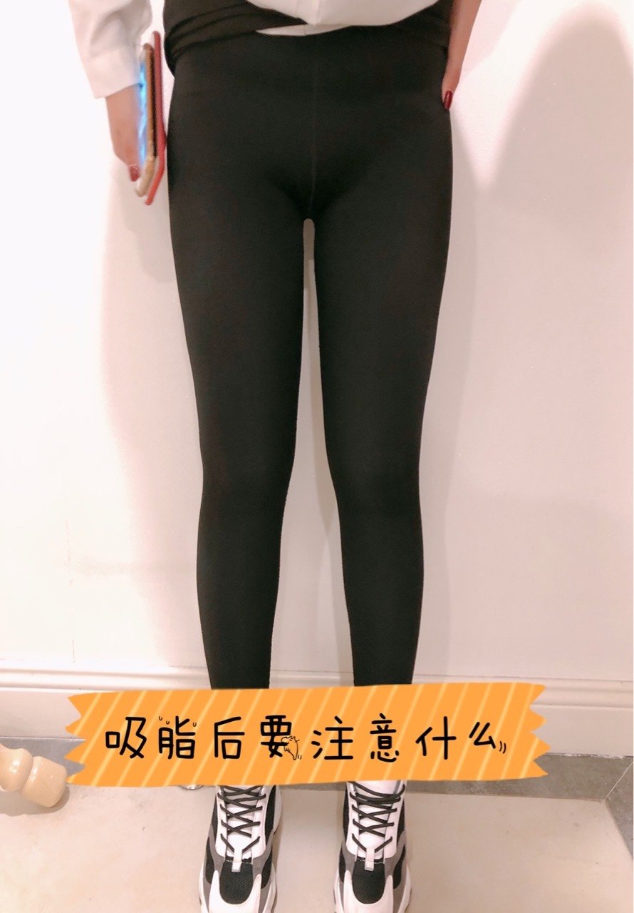 大腿环吸塑身裤测评