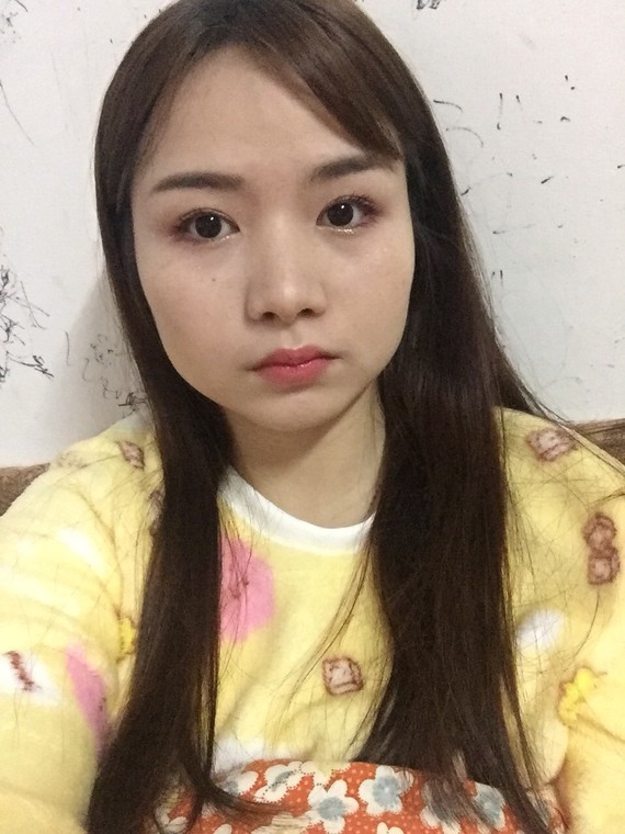 用头发挡了还好 拉开头发脸型非常难看 该做什么项目让脸线条好看点